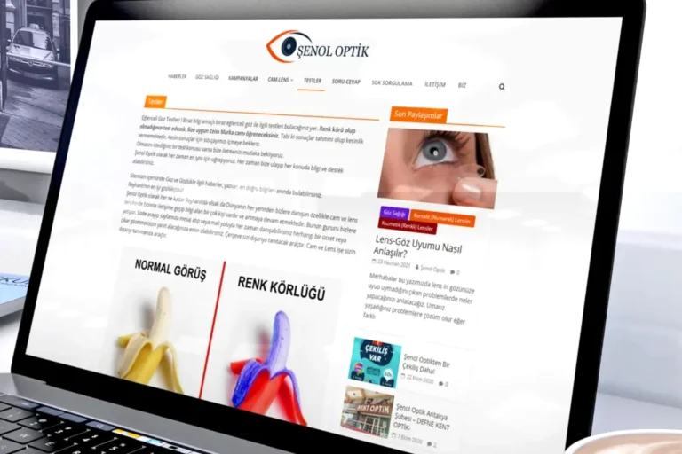 Şenol Optik Blog Sitesi Tasarımı